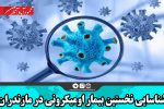 شناسایی نخستین بیمار اومیکرونی در مازندران